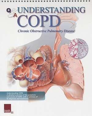 Q&A Understanding COPD de Scientific Publishing