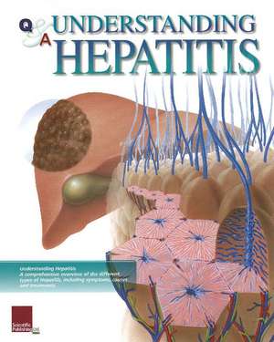 Understanding Hepatitis Flip Chart de Scientific Publishing
