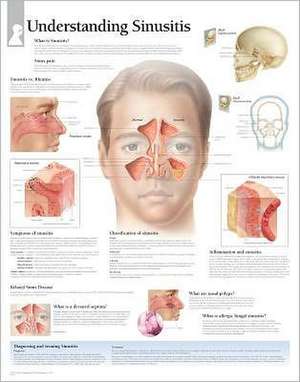 Understanding Sinusitis Chart: Laminated Wall Chart de various