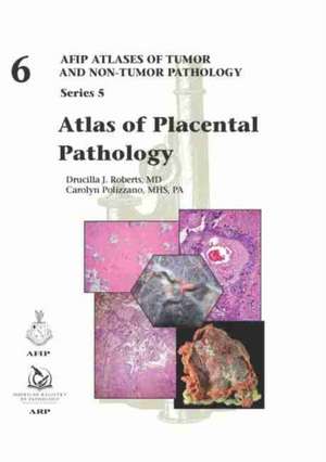 Atlas of Placental Pathology de Carolyn Polizzano