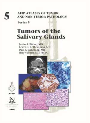 Tumors of the Salivary Glands de Ilan Weinreb