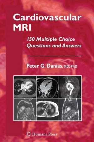 Cardiovascular MRI: 150 Multiple-Choice Questions and Answers de Peter G. Danias