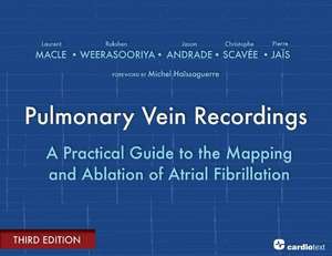 Pulmonary Vein Recordings: A Practical Guide to the Mapping and Ablation of Atrial Fibrillation de Laurent Macle