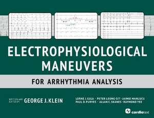 Electrophysiological Maneuvers for Arrhythmia Analysis de George J. Klein