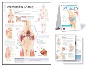 Understanding Arthritis Study Set