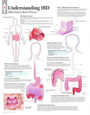 Understanding IBD de Scientific Publishing