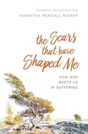 The Scars That Have Shaped Me de Vaneetha Rendall Risner