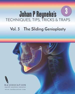 Johan P. Reyneke's Techniques, Tips, Tricks and Traps Vol 3: The Sliding Genioplasty de Johan P. Reyneke