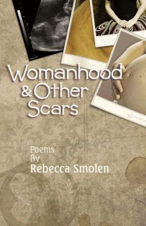 Womanhood & Other Scars de Rebecca Smolen