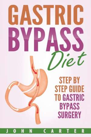 Gastric Bypass Diet de John Carter