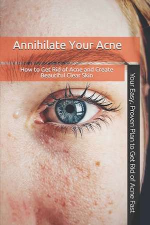 ANNIHILATE YOUR ACNE