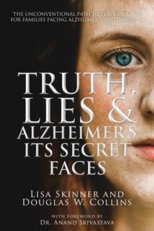 Truth, Lies & Alzheimer's de Lisa Skinner