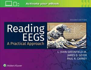 Reading EEGs: A Practical Approach Approach