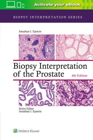 Biopsy Interpretation of the Prostate de Jonathan I. Epstein