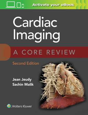 Cardiac Imaging: A Core Review de Jean Jeudy