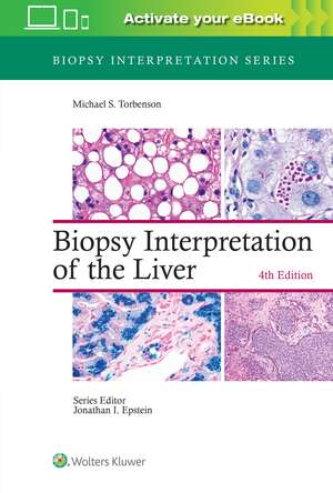 Biopsy Interpretation of the Liver de Michael Torbenson MD