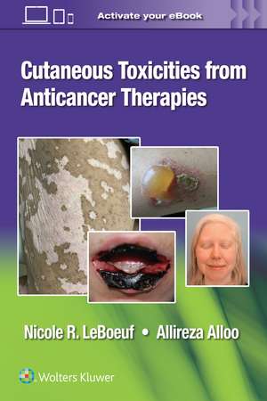 Cutaneous Toxicities from Anticancer Therapies de Dr. Nicole LeBoeuf