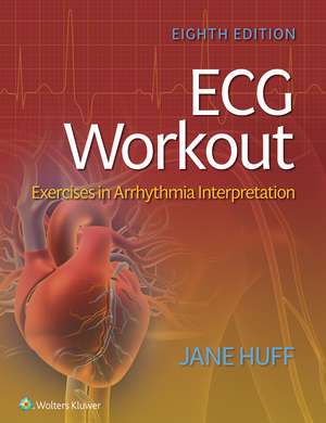 ECG Workout: Exercises in Arrhythmia Interpretation de LOREDA J. HUFF