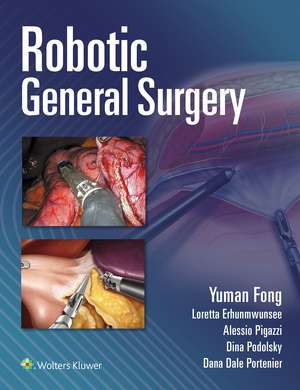 Robotic General Surgery de Yuman Fong