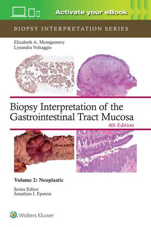 Biopsy Interpretation of the Gastrointestinal Tract Mucosa Volume 2: Neoplastic: Print + eBook with Multimedia de ELIZABETH ANNE MONTGOMERY