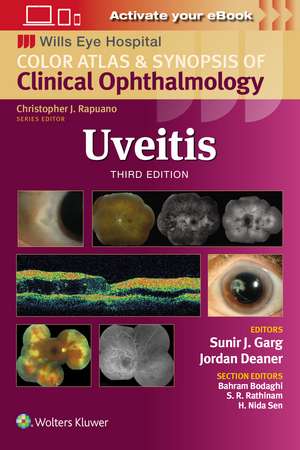 Uveitis de Sunir J. Garg, MD