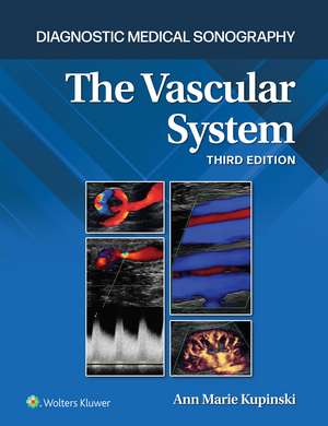 Diagnostic Medical Sonography: The Vascular System 3e Lippincott Connect Print Book and Digital Access Card Package de Ann Marie Kupinski