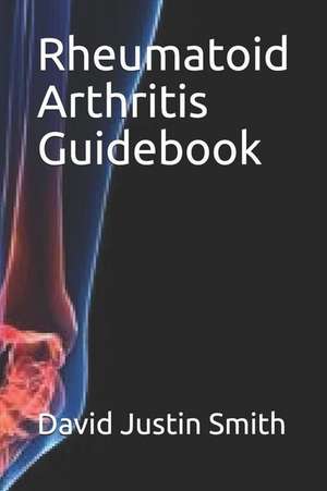 Rheumatoid Arthritis Guidebook de David Justin Smith