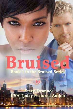 Bruised de Stacy-Deanne