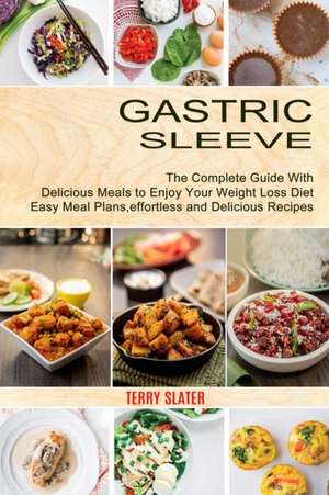 Gastric Sleeve de Terry Slater