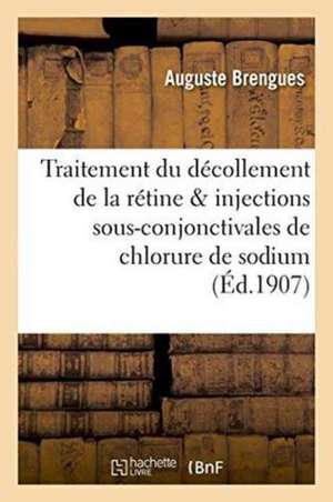 Du Traitement Du Décollement de la Rétine & Injections Sous-Conjonctivales de Chlorure de Sodium de Brengues