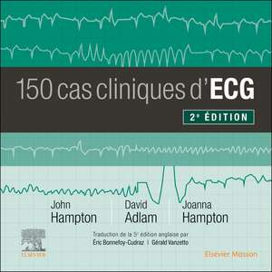 150 cas cliniques d'ECG de David Adlam