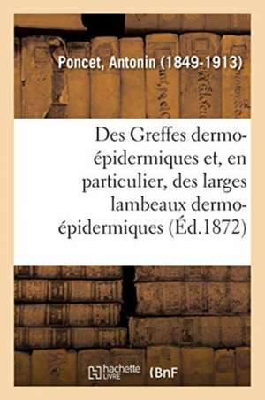 Des Greffes Dermo-Épidermiques Et, En Particulier, Des Larges Lambeaux Dermo-Épidermiques de Antonin Poncet