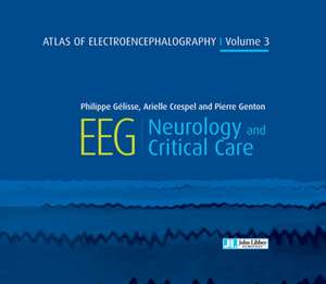 Atlas of Electroencephalography Volume 3 de Philippe Gelisse