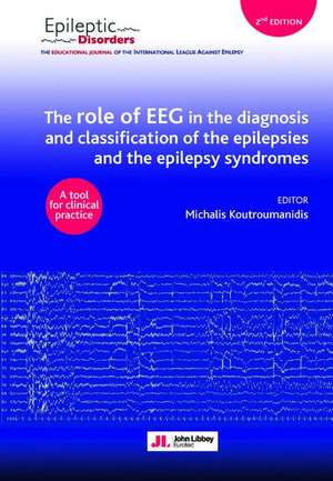 The role of EEG in the diagnosis and classification of the epilepsies and the epilepsy syndromes: A tool for clinical practice de Michalis Koutroumanidis