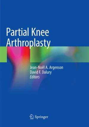 Partial Knee Arthroplasty de Jean-Noël A. Argenson