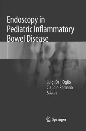 Endoscopy in Pediatric Inflammatory Bowel Disease de Luigi Dall'Oglio