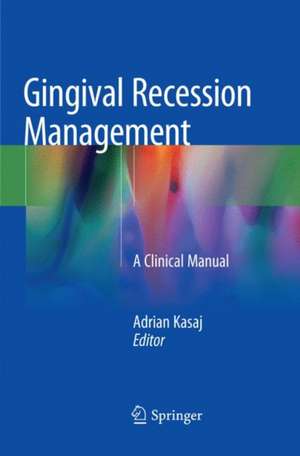 Gingival Recession Management: A Clinical Manual de Adrian Kasaj