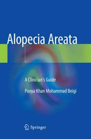 Alopecia Areata: A Clinician's Guide de Pooya Khan Mohammad Beigi