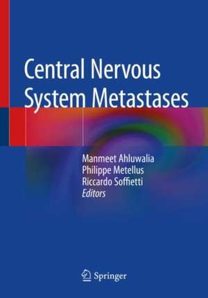 Central Nervous System Metastases de Manmeet Ahluwalia