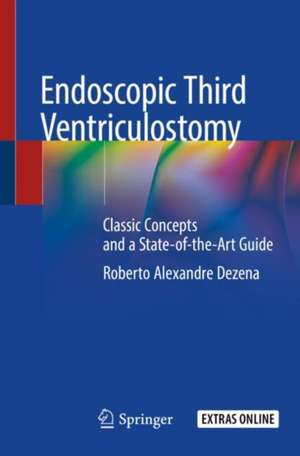 Endoscopic Third Ventriculostomy: Classic Concepts and a State-of-the-Art Guide de Roberto Alexandre Dezena