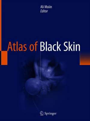 Atlas of Black Skin de Ali Moiin