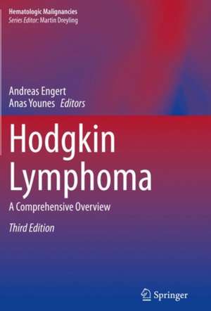 Hodgkin Lymphoma: A Comprehensive Overview de Andreas Engert