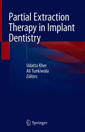 Partial Extraction Therapy in Implant Dentistry de Udatta Kher