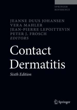 Contact Dermatitis de Jeanne Duus Johansen