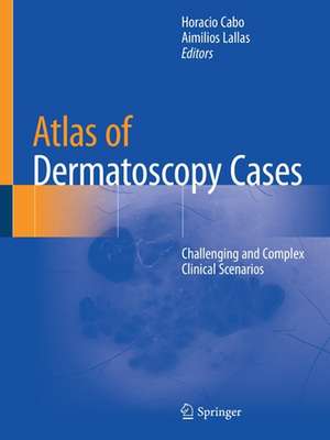  Atlas of Dermatoscopy Cases: Challenging and Complex Clinical Scenarios de Horacio Cabo