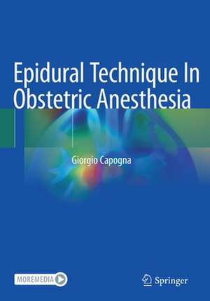 Epidural Technique In Obstetric Anesthesia de Giorgio Capogna