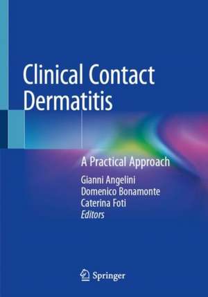 Clinical Contact Dermatitis: A Practical Approach de Gianni Angelini