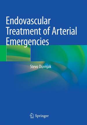 Endovascular Treatment of Arterial Emergencies de Stevo Duvnjak