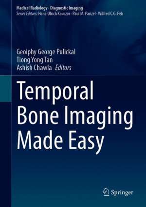 Temporal Bone Imaging Made Easy de Geoiphy George Pulickal