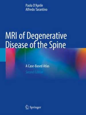 MRI of Degenerative Disease of the Spine: A Case-Based Atlas de Paola D'Aprile